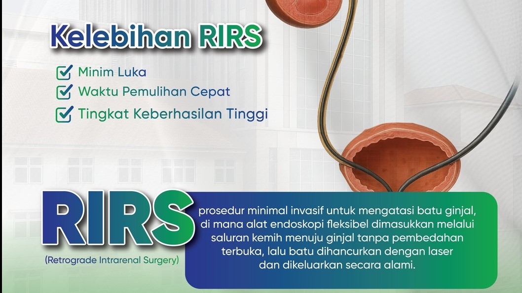 RIRS